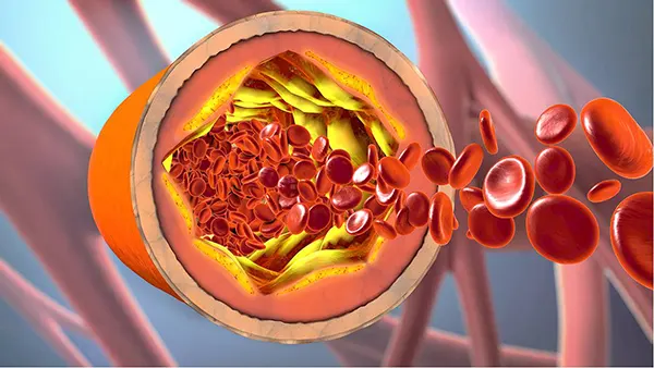 El colesterol. Entenderlo de verdad, saber interpretar las analíticas y nuestro riesgo cardiovascular.